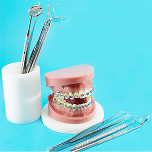 braces-5ce8119edda16