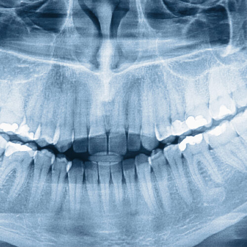 circle-image-5d03d8334832a